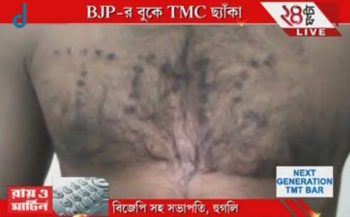 EXCLUSIVE: BJP কর্মীর বুকে সিগারেটের ছ্যাঁকা দিয়ে লেখা হল TMC 