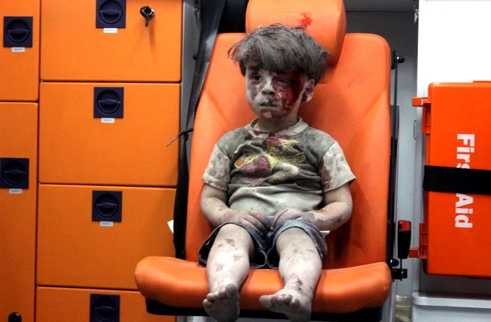 Covered in dust and blood, 5-year-old Omran Daqneesh