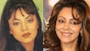 Bollywood Stars Before and After Cosmetic Surgery 12