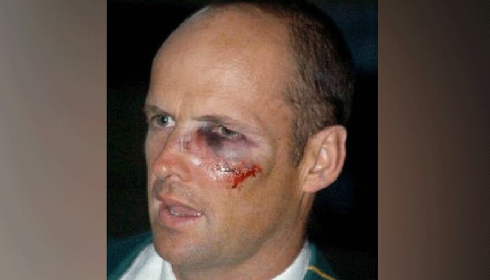 cricketers who played through injuries 4