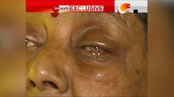চোখ যাওয়ার পর, ৩ সদস্যের কমিটি গঠন হাসপাতালের