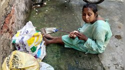হুঁশ নেই হাসপাতালের! অ্যাপ্রন, ইউরিন ব্যাগ নিয়ে রাস্তায় ঘুরে বেড়ালেন রোগী
