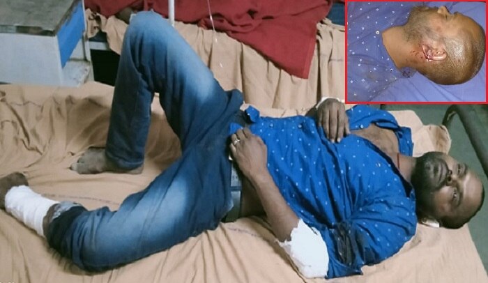 পদ্মশিবিরে Jitendra যোগের পরই উত্তেজনা, রড মেরে 'মাথা ফাটানো' হল BJP কর্মীর পদ্মশিবিরে Jitendra যোগের পরই উত্তেজনা, রড মেরে 'মাথা ফাটানো' হল BJP কর্মীর