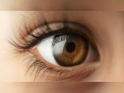 Surat tasodifan yalangoch holda olingan