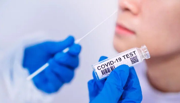 Coronavirus: দৈনিক সংক্রমণ কমল অনেকটাই, নামল ৩০ হাজারের কোটায়