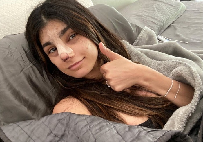 Mia Khalifa nose surgery