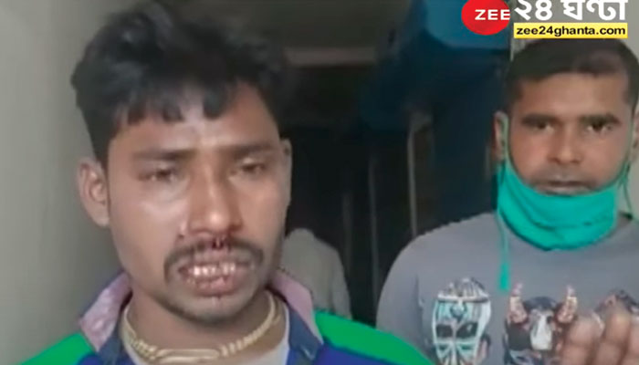 Chandrakona: পতাকা-ব্যানার লাগানোকে কেন্দ্র করে সংঘর্ষ চন্দ্রকোনায়, জখম এক বিজেপি কর্মী Chandrakona: পতাকা-ব্যানার লাগানোকে কেন্দ্র করে সংঘর্ষ চন্দ্রকোনায়, জখম এক বিজেপি কর্মী