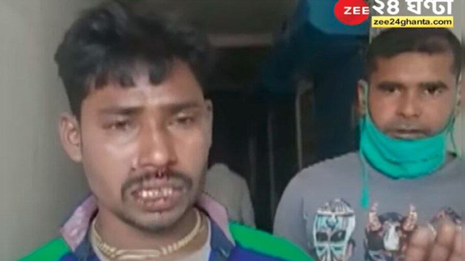 Chandrakona: পতাকা-ব্যানার লাগানোকে কেন্দ্র করে সংঘর্ষ চন্দ্রকোনায়, জখম এক বিজেপি কর্মী