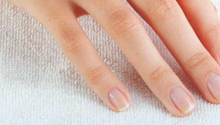 White Spots On Nails: আপনার নখে কি সাদা দাগ আছে? অবিলম্বে সাবধান হন! 