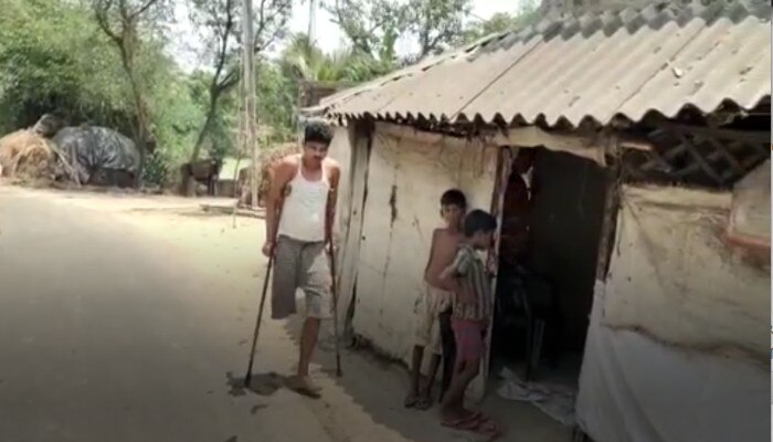 দূর্ঘটনায় হারিয়েছেন ডান পা, মেলেনি সরকারি সাহায্য; ছাতা তৈরি করে সংসার চালাচ্ছেন গণেশ