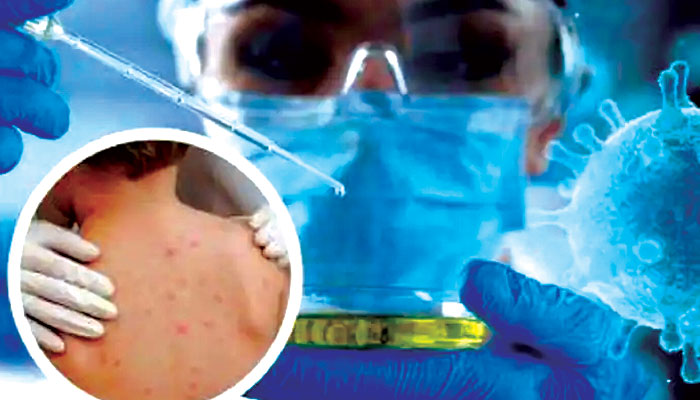 Monkeypox: শিশুরা মাঙ্কিপক্সে বেশি আক্রান্ত হতে পারে, সতর্ক করল ICMR
