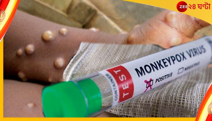 Monkeypox: বাড়ছে মাঙ্কিপক্সের আতঙ্ক, বিদেশ থেকে আসা যাত্রীদের খুঁটিয়ে পরীক্ষা করতে নির্দেশ কেন্দ্রের