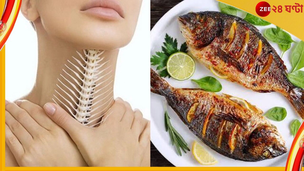 Fish Bone stuck in your throat, what to do? গলায় আটকে মাছের কাঁটা