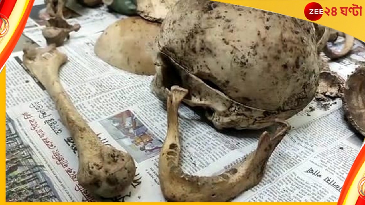 Siliguri skeleton: আর্বজনার স্তুপে বস্তাবন্দি খুলি, হাড়গোড়! আতঙ্ক শিলিগুড়িতে