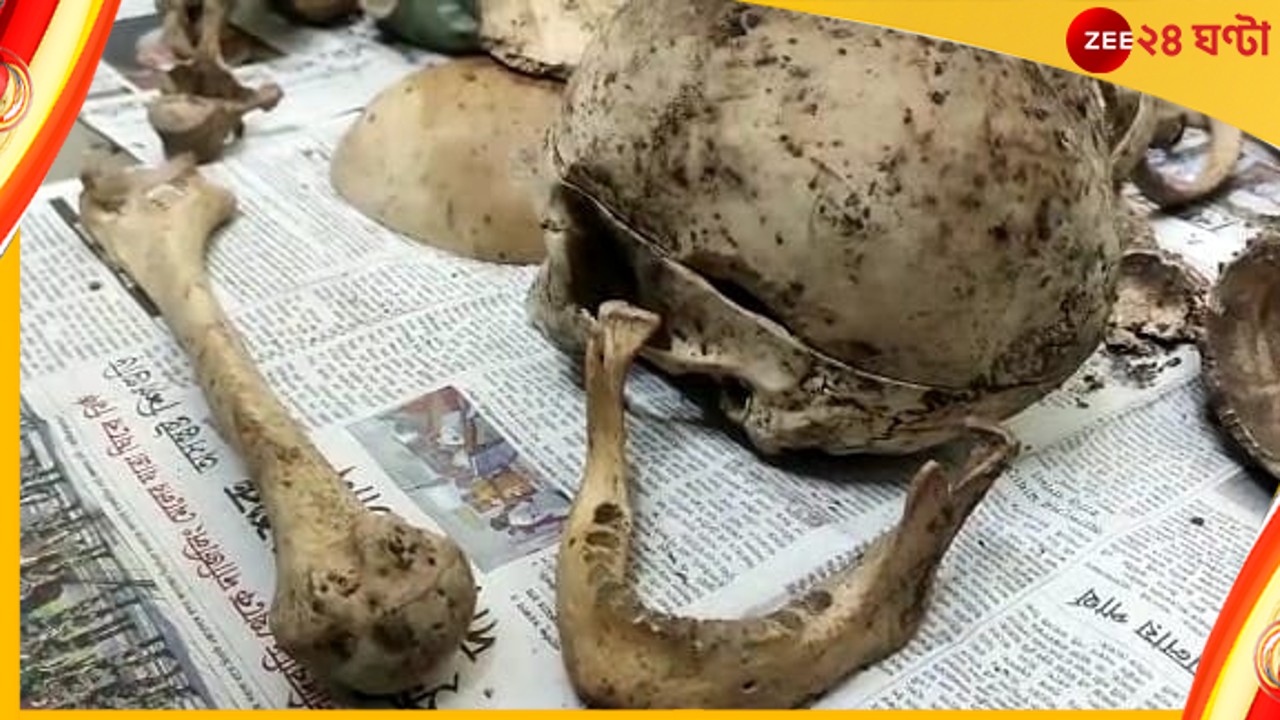 Siliguri skeleton: আর্বজনার স্তুপে বস্তাবন্দি খুলি, হাড়গোড়! আতঙ্ক শিলিগুড়িতে Siliguri skeleton: আর্বজনার স্তুপে বস্তাবন্দি খুলি, হাড়গোড়! আতঙ্ক শিলিগুড়িতে