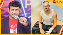 আগুনে ঝলসেছে মুখ, জখম ফুসফুস, এখন কেমন আছেন আবু হেনা রনি?