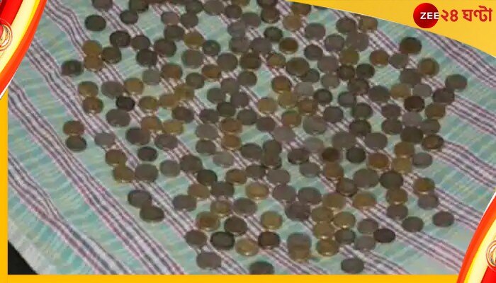 187 Coins In Stomach: ইচ্ছে হলেই গিলে ফেলতেন, পেট কাটতেই পাকস্থলী থেকে বেরল ১৮৭টি কয়েন!