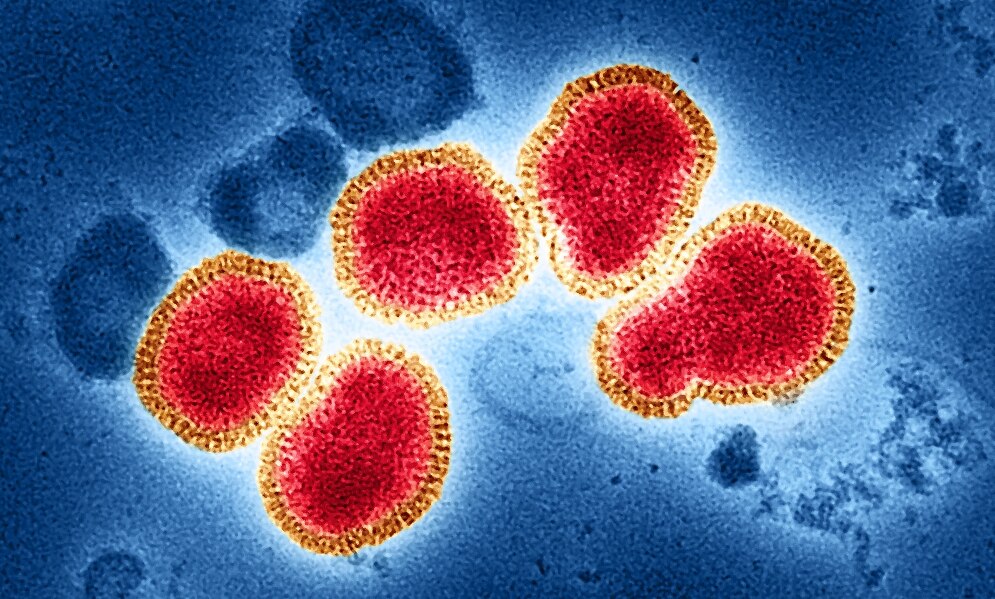 H3N2 Influenza Vs COVID-19: Symptoms