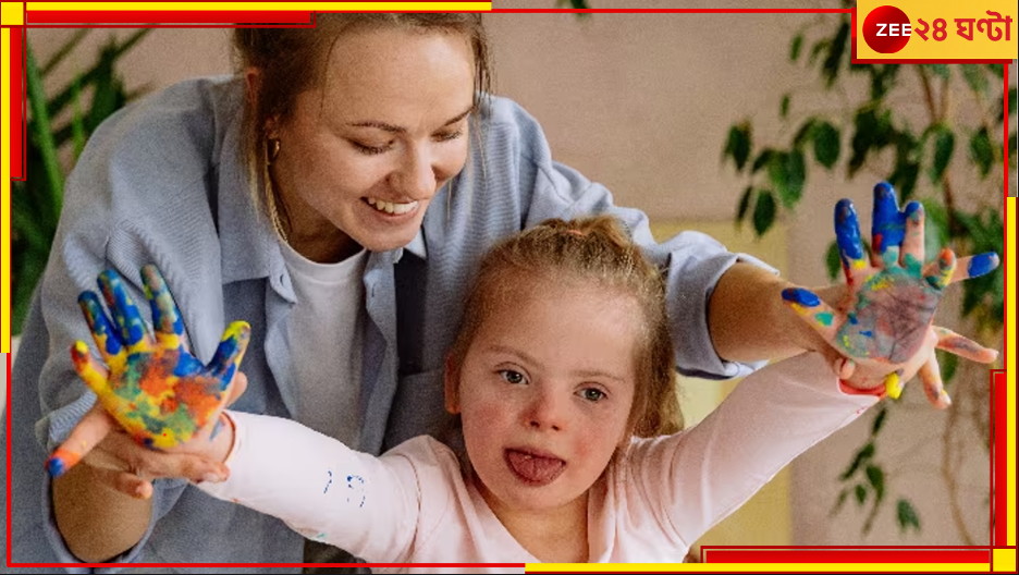 World Down Syndrome Day 2023: গর্ভাবস্থায় কয়েকটি সামান্য পরীক্ষাই নির্মূল করতে পারে 'ডাউন সিনড্রোম'- এর অভিশাপ! World Down Syndrome Day 2023: গর্ভাবস্থায় কয়েকটি সামান্য পরীক্ষাই নির্মূল করতে পারে 'ডাউন সিনড্রোম'- এর অভিশাপ!