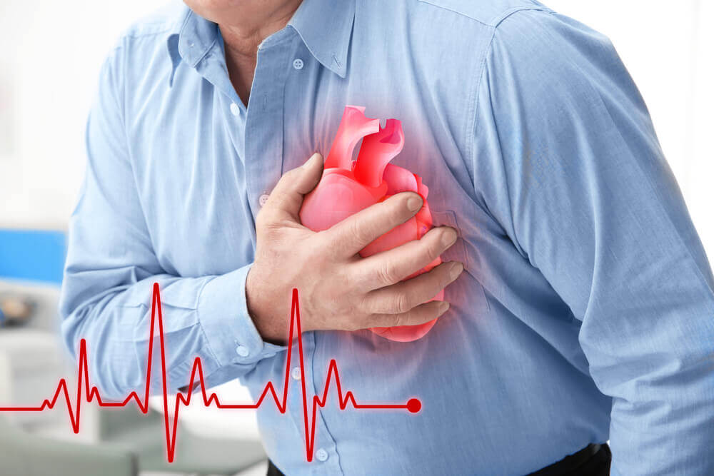 Covid, Heart Attacks Linked?