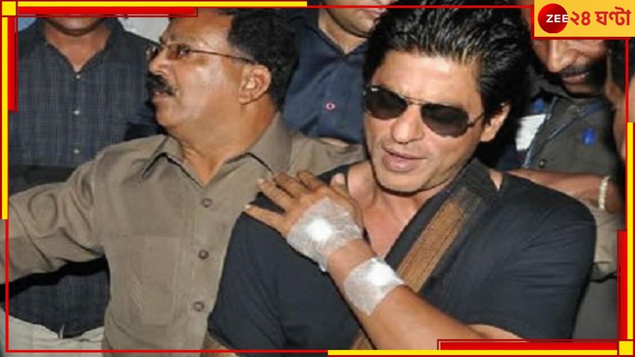 Shah Rukh Khan injured: নাকে গুরুতর চোট! শ্যুটিং চলাকালীন আহত শাহরুখের অস্ত্রোপচার