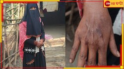 অন্য মহিলার সঙ্গে ঘনিষ্ঠ স্বামী, প্রতিবাদ করায় স্ত্রীকে অ্যাসিড খাইয়ে খুনের চেষ্টা!
