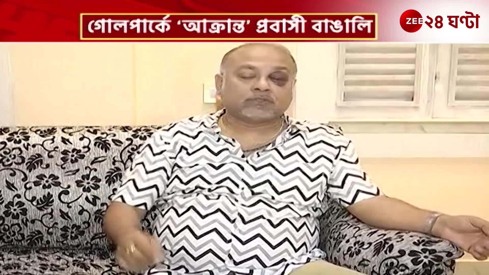 Kolkata News: শহরে প্রমোটারের কোপে পড়ে আক্রান্ত প্রবাসী বাঙালি | Zee ...