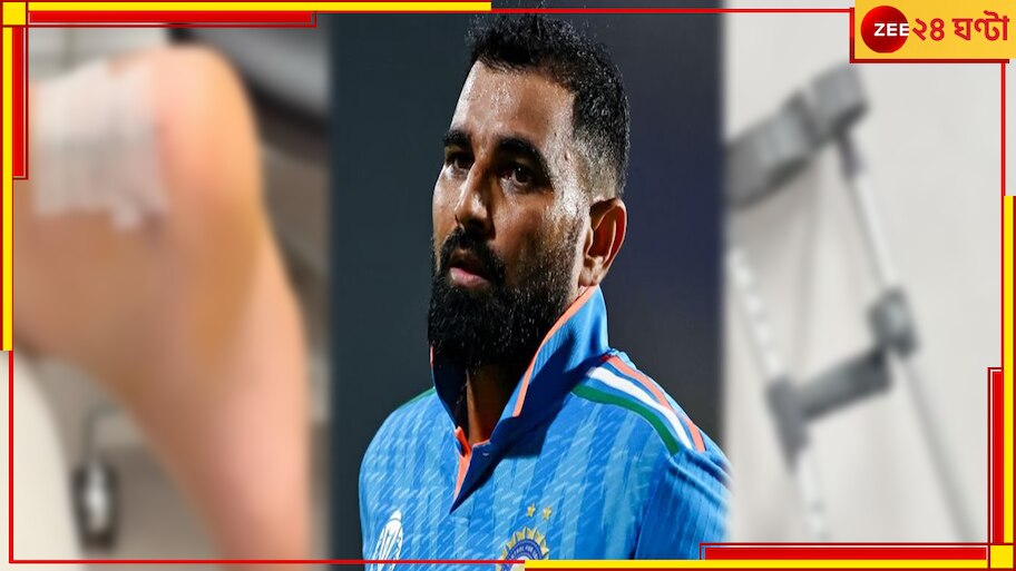 Mohammed Shami Injury Update: গোড়ালিতে সার্জিকাল টেপ, বিছানার পাশে ...