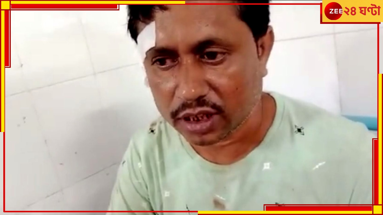 BJP Worker Attacked:  তৃণমূল ছেড়ে বিজেপি যোগদানের &#039;অপরাধে&#039; বেধড়ক মার, করা হল এই নক্কারজনক কাজ