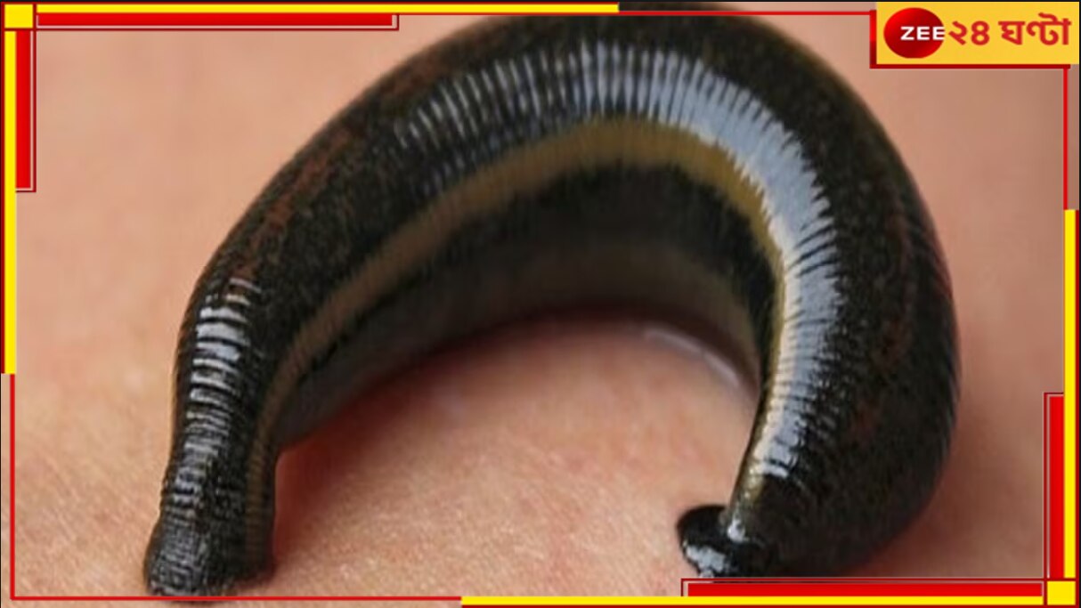 Leech found inside nose: ভয়াবহ! চুপ করে ভিতরে বসে চুষে খাচ্ছে রক্ত, কী ওটা? 