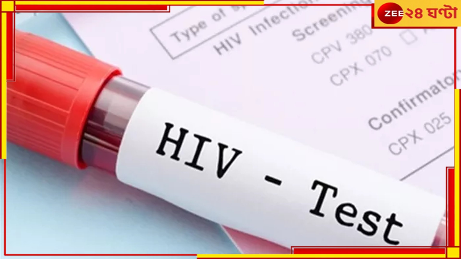 AIDS in Tripura: এইডসে আক্রান্ত ৮২৮ জন, মৃত ৪৭ পড়ুুয়া! রাজ্যে দ্রুত ছড়াচ্ছে এই মারণ ভাইরাস...