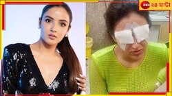 লেন্স পরতেই চোখে ব্যথা, দৃষ্টিশক্তি হারাতে বসেছেন জনপ্রিয় অভিনেত্রী জেসমিন!