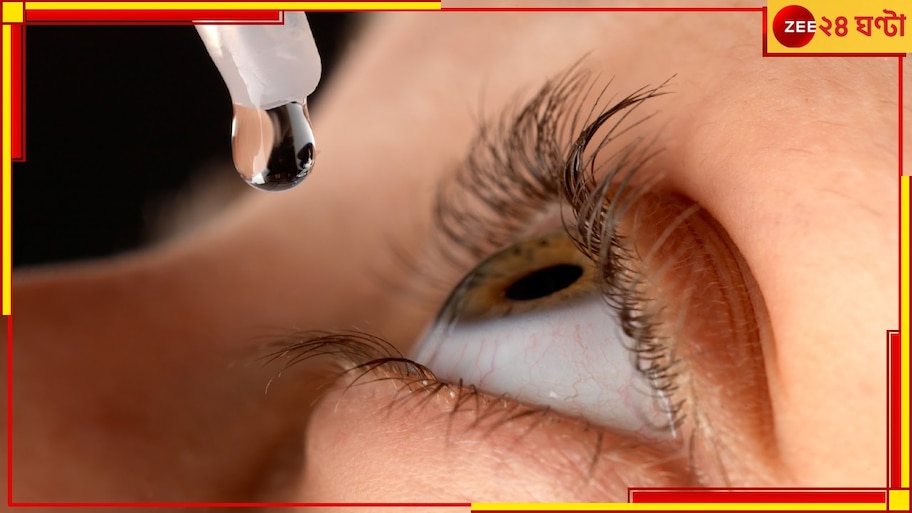 Cataract Surgery: চোখের অপারেশনের পর আই ড্রপের বদলে পেটে ব্যথার ওষুধ! সুস্থ হওয়ার বদলে রোগী...