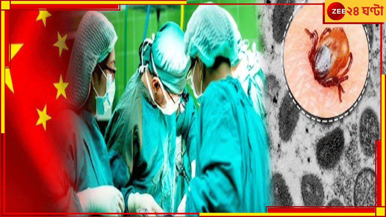 New Virus Found In China: করোনার পর ফের মারণ ভাইরাস! ঝাঁজরা করছে মাথা থেকে স্নায়ু, থরথরিয়ে কাঁপছে চিন... New Virus Found In China: করোনার পর ফের মারণ ভাইরাস! ঝাঁজরা করছে মাথা থেকে স্নায়ু, থরথরিয়ে কাঁপছে চিন...