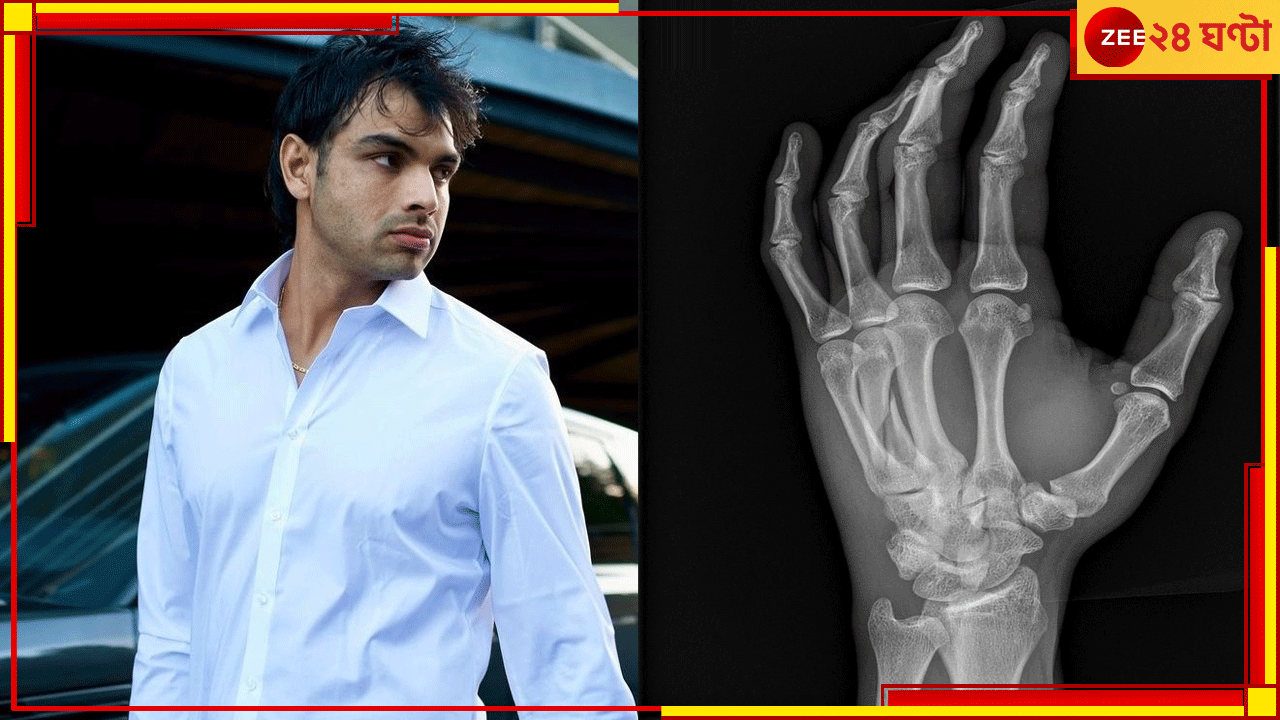 Neeraj Chopra: এক্স-রে দেখে আঁতকে উঠল সবাই! বর্শা তুলে রাখছেন 'সোনার ছেলে'? তোলপাড় নেটপাড়া... Neeraj Chopra: এক্স-রে দেখে আঁতকে উঠল সবাই! বর্শা তুলে রাখছেন 'সোনার ছেলে'? তোলপাড় নেটপাড়া...