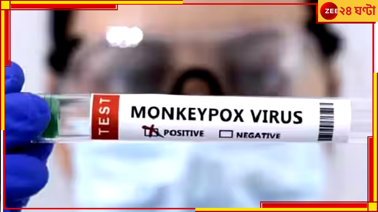 Mpox: মাঙ্কিপক্স ধরা পড়লেই কোয়ারেন্টাইন, যাত্রীদের খুঁটিয়ে পরীক্ষা বিমানবন্দরে Mpox: মাঙ্কিপক্স ধরা পড়লেই কোয়ারেন্টাইন, যাত্রীদের খুঁটিয়ে পরীক্ষা বিমানবন্দরে