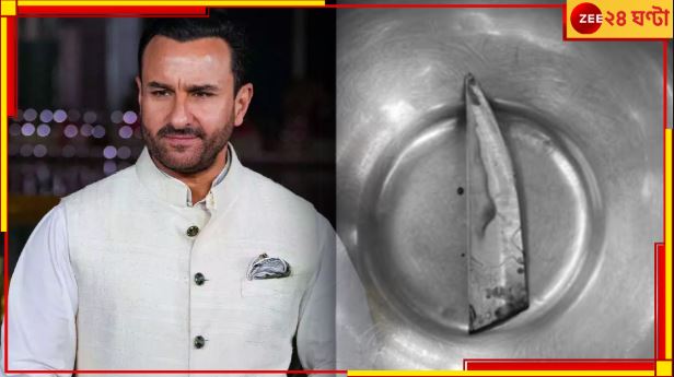 Saif Ali Khan Stabbed: বরাত জোরে বাঁচলেন সইফ, &#039;ছুরিটা আর একটু গভীরে গেলেই...!&#039;