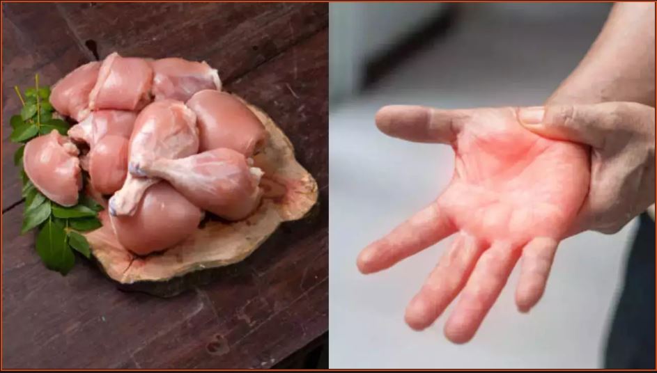 Raw Chicken Give You Paralysis