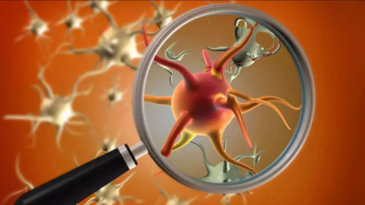 Mystery illness: রক্তক্ষরণ, জ্বর আর কয়েক ঘণ্টাতেই মৃত্যু! পৃথিবী