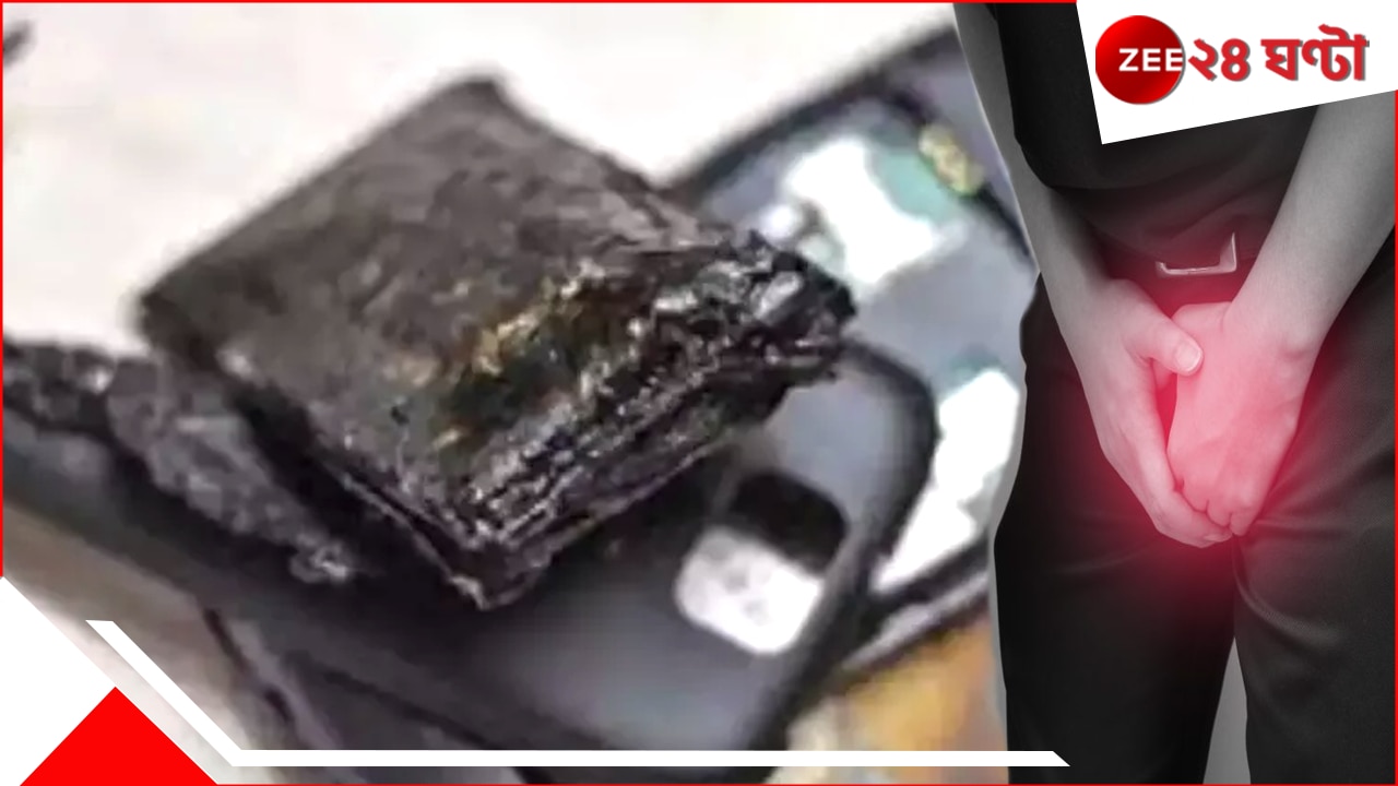 Mobile Phone Exploded: পকেটেই ফাটল মোবাইল ফোন, গোপনাঙ্গ ঝলসে গিয়ে…