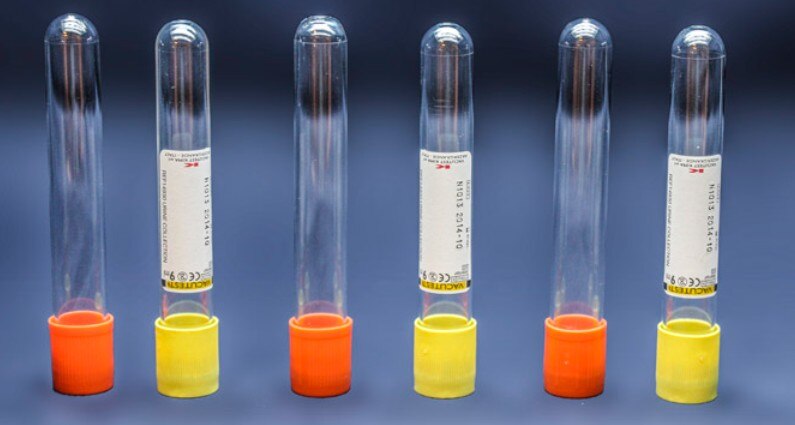 অনুমোদনহীন বেআইনি 'ক্লিনিক্যাল ট্রায়াল'! Unauthorized Clinical Trial in Gujrat hospital