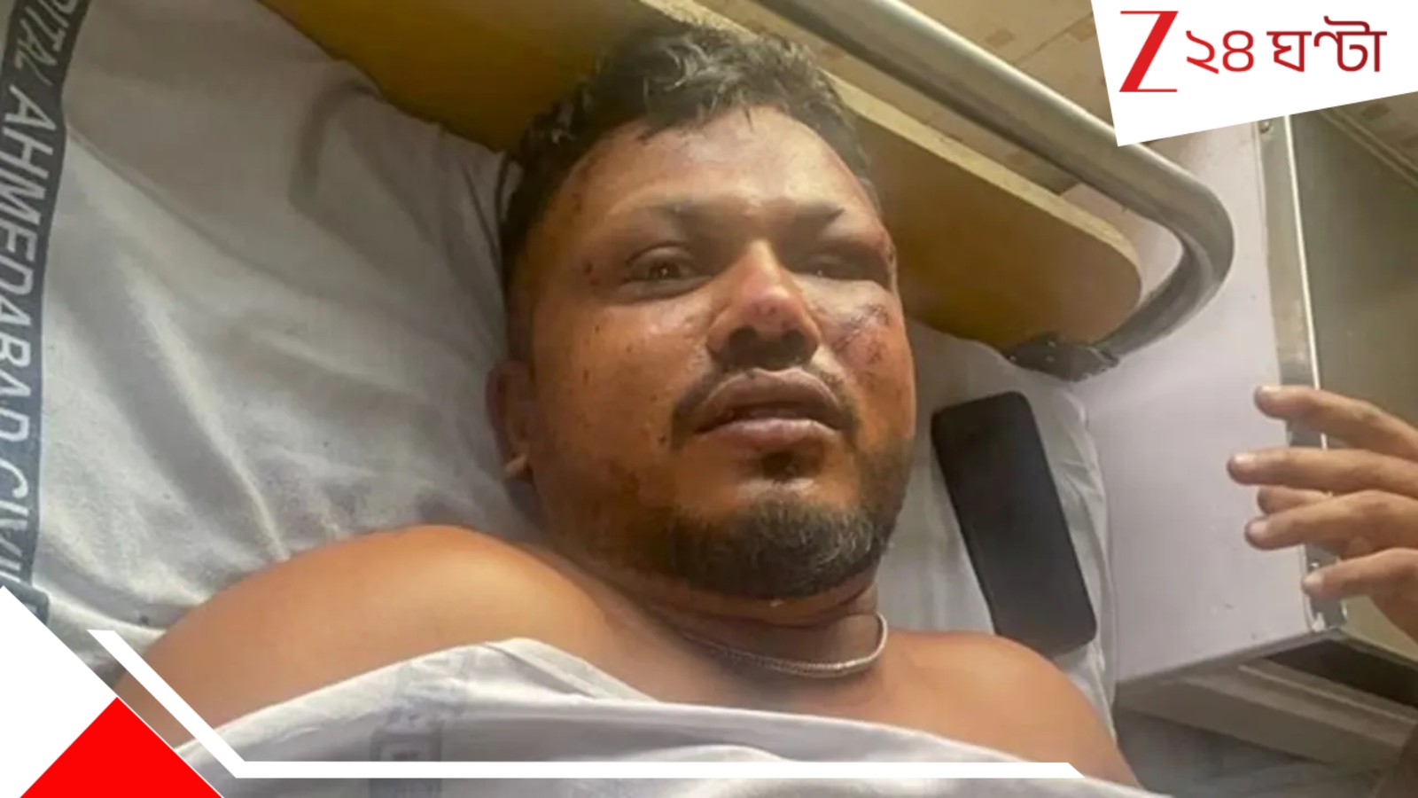 Ahmedabad Plane Crash: 'চারদিকে পোড়া দেহের স্তূপ, উঠে দাঁড়িয়ে উদ্ভ্রান্তের মতো দৌড়ে বেরিয়ে আসি...', দুর্ঘটনার মুহূর্তের বর্ণনায় রমেশ Ahmedabad Plane Crash: 'চারদিকে পোড়া দেহের স্তূপ, উঠে দাঁড়িয়ে উদ্ভ্রান্তের মতো দৌড়ে বেরিয়ে আসি...', দুর্ঘটনার মুহূর্তের বর্ণনায় রমেশ