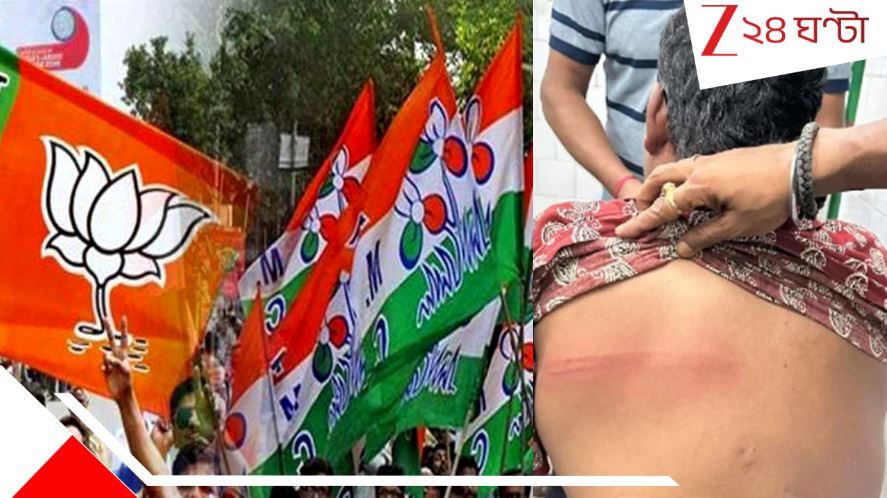 Bankura: মন্ত্রীর স্বামীকে ভরা বাজারে বেধড়ক মার! অভিযোগের তিরে বিজেপি... Bankura: মন্ত্রীর স্বামীকে ভরা বাজারে বেধড়ক মার! অভিযোগের তিরে বিজেপি...