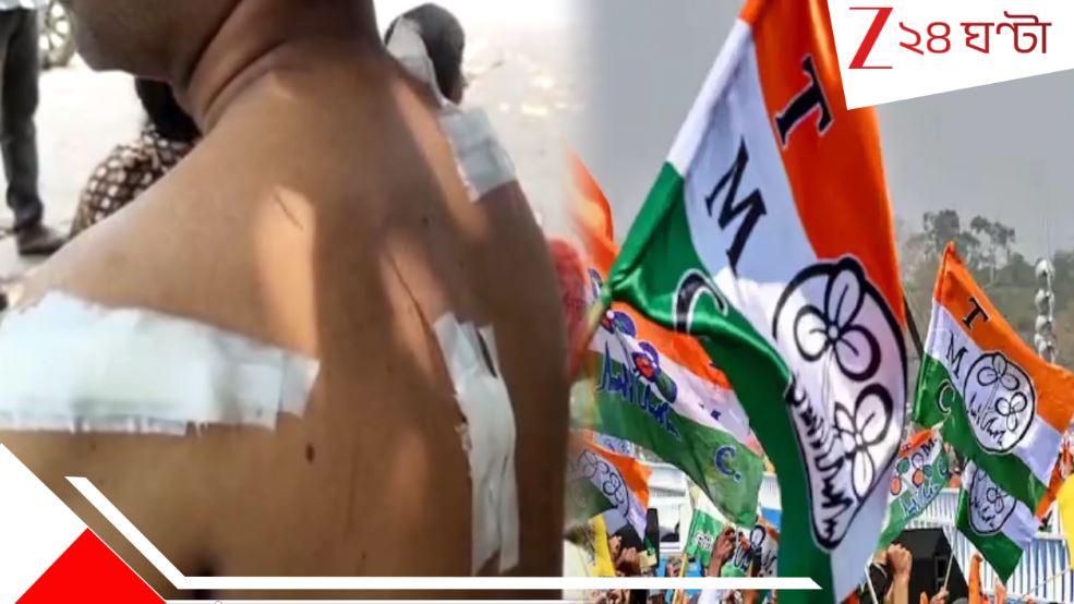 তৃণমূল পঞ্চায়েত সদস্যের স্বামীকে প্রকাশ্যে দেদার ধারাল অস্ত্রের কোপ! অভিযোগ…| husband of the tmc Panchayat member injured by sharp weapon in malda