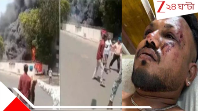 Ahmedabad Plane Crash: 'আগুনের গোলা থেকে হেঁটে বেরোলেন, বেঁচে গিয়েও ফের আগুনেই ঝাঁপ দিতে যাচ্ছিলেন!' ভয়ংকর সত্যি... Ahmedabad Plane Crash: 'আগুনের গোলা থেকে হেঁটে বেরোলেন, বেঁচে গিয়েও ফের আগুনেই ঝাঁপ দিতে যাচ্ছিলেন!' ভয়ংকর সত্যি...