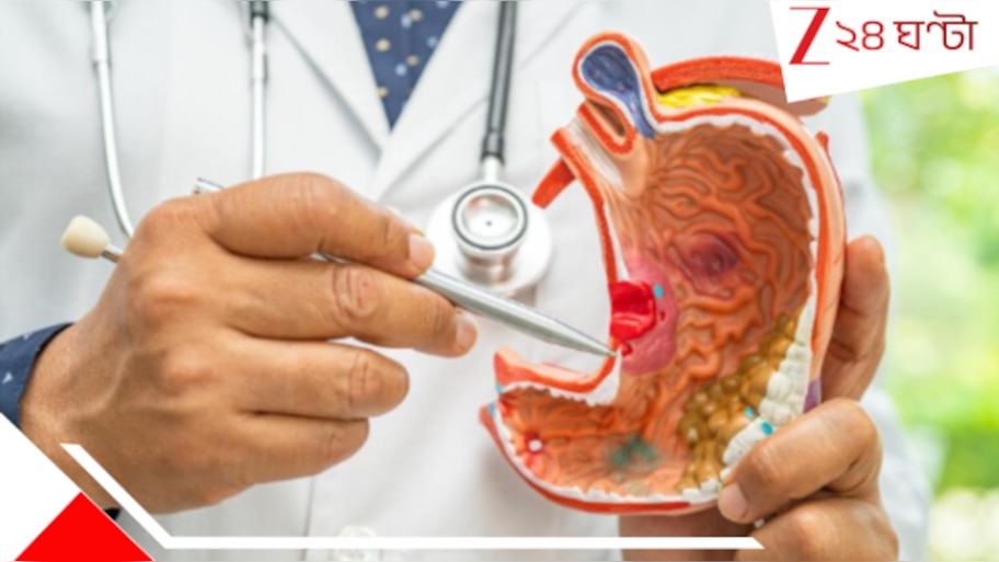 Stomach Cancer: ২০০৮ এর পর জন্ম? ভবিষ্যতে হতে পারে মারণরোগ!