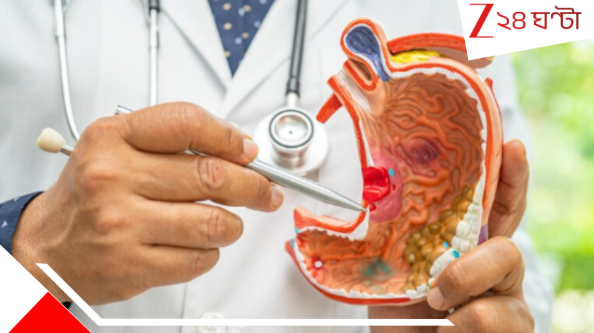 Stomach Cancer: ২০০৮ এর পর জন্ম? ভবিষ্যতে হতে পারে মারণরোগ! Stomach Cancer: ২০০৮ এর পর জন্ম? ভবিষ্যতে হতে পারে মারণরোগ!