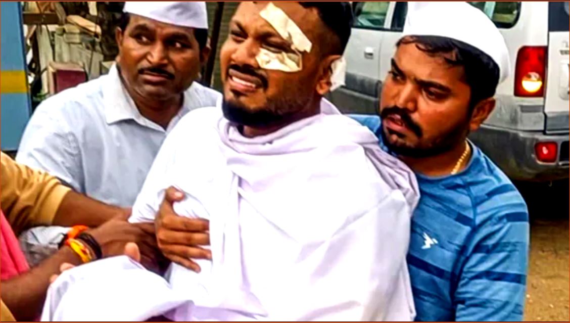 Dunna Ramesh সারারাত খোলা চোখ, নির্বাক চাহনি! একমাস পরেও দুঃস্বপ্ন আর আতঙ্কে ...