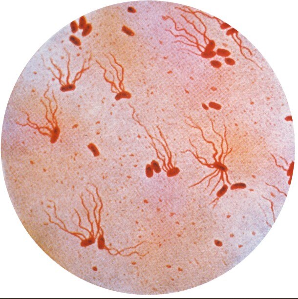 Deadly Virus Salmonella typhi spreading as Superbug