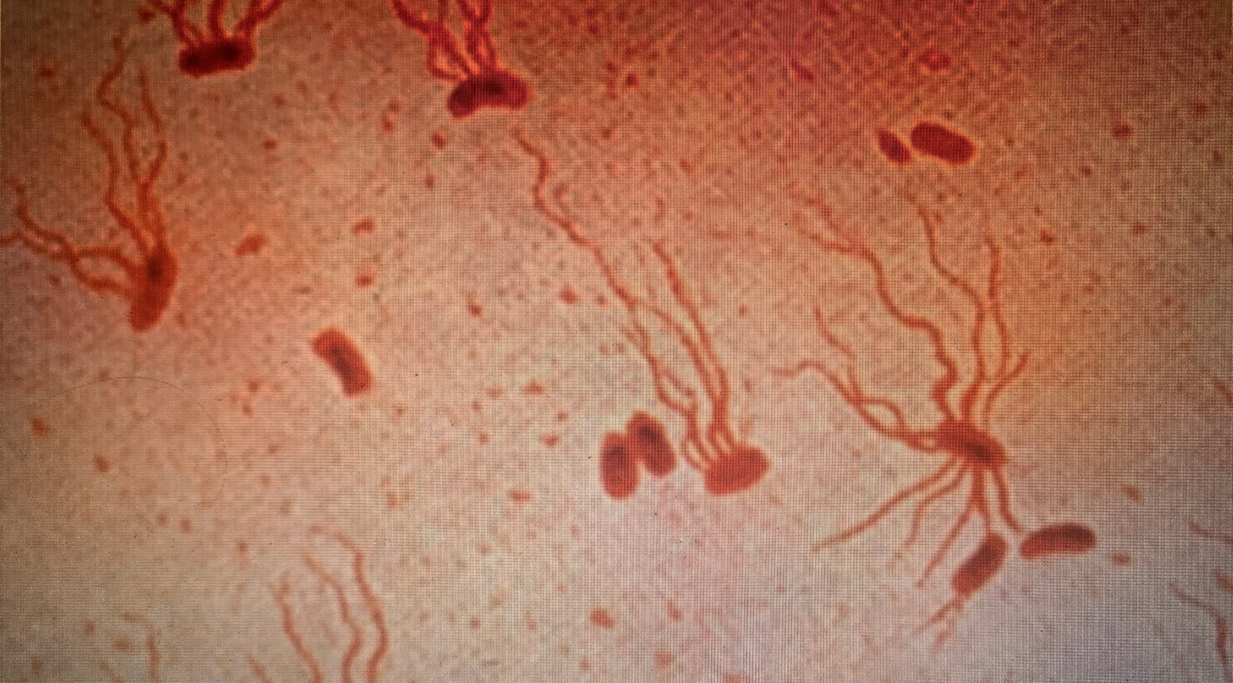 Deadly Virus Salmonella typhi spreading as Superbug